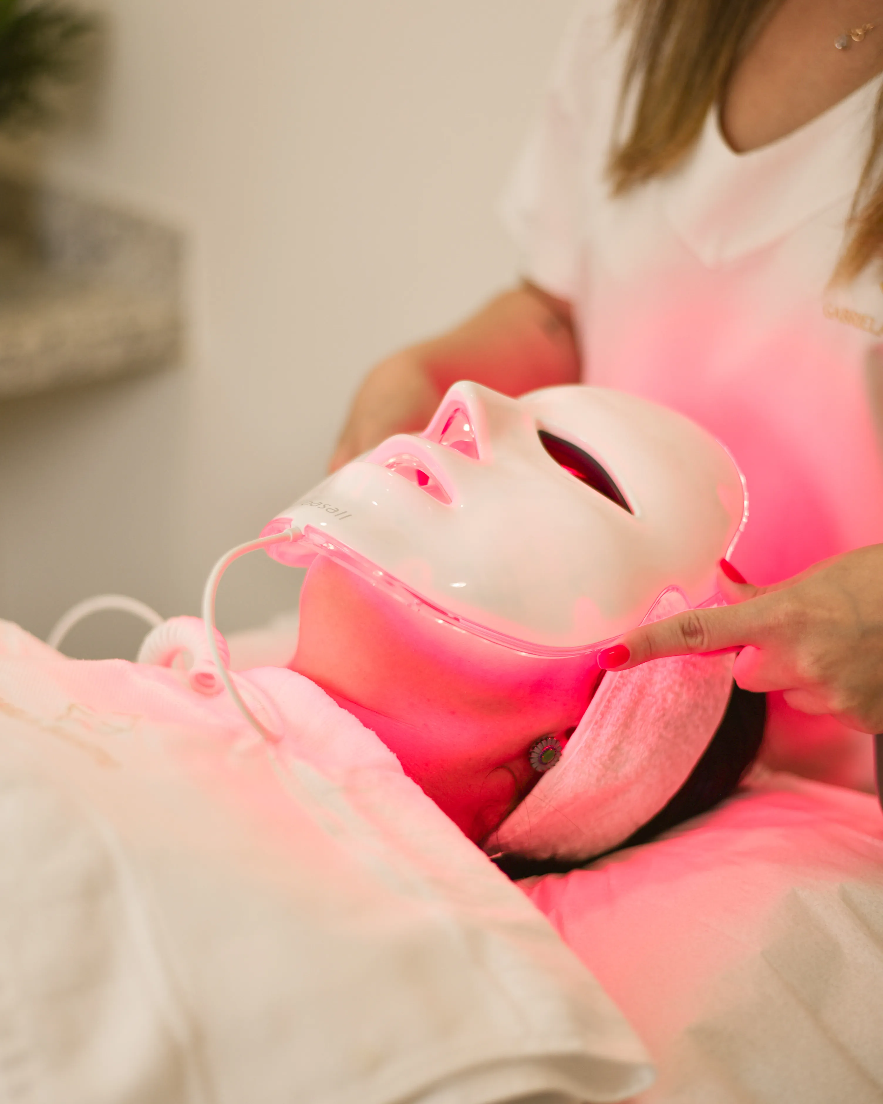 Tratamento para Rosácea - Condição inflamatória crônica que causa vermelhidão e sensibilidade